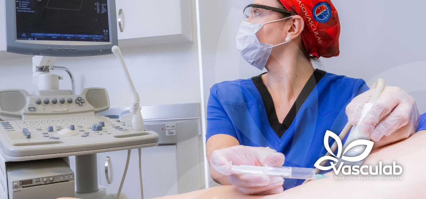 Cirugia_de_varices_Radiofrecuencia_Vasculab